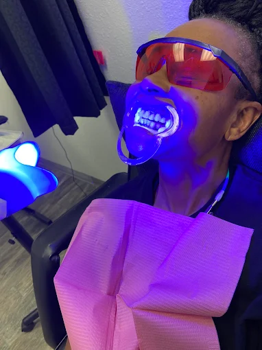 Hollywood Smiles 409 – Advanced Teeth Whitening & Veneer Solutions Hollywood Smiles 409 – Advanced Teeth Whitening & Veneer Solutions