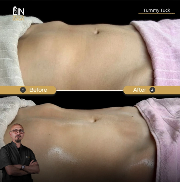 <strong>Flat Belly Clinic: Panduan Mengenal Klinik, Dokter, dan Layanan Perawatan Abdomen</strong>